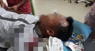 Kepala Warga Kena Peluru Nyasar, Satreskrim Polres Batanghari Buru Pelaku